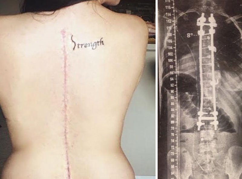 30 ideia criativas de tatuagem para embelezar qualquer cicatriz 8
