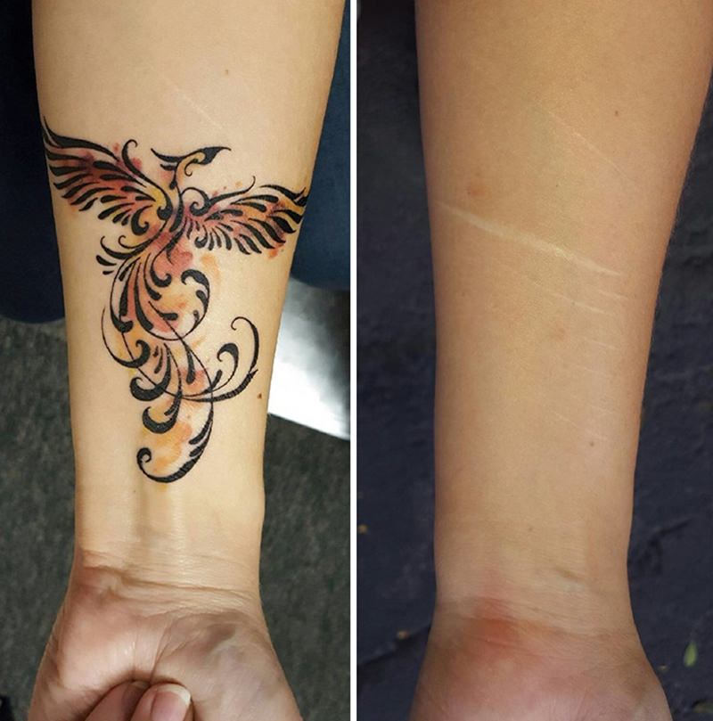 30 ideia criativas de tatuagem para embelezar qualquer cicatriz 9