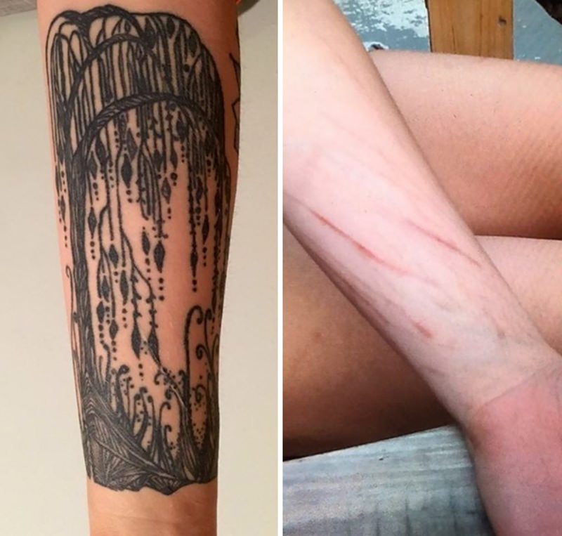 30 ideia criativas de tatuagem para embelezar qualquer cicatriz 16