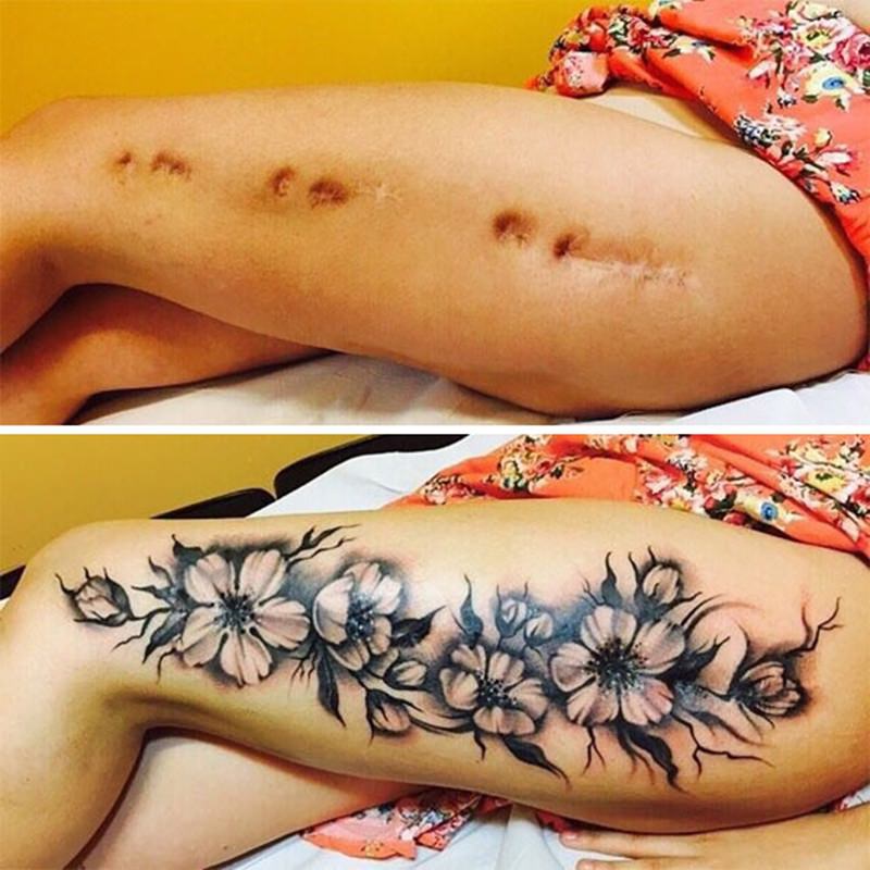 30 ideia criativas de tatuagem para embelezar qualquer cicatriz 29