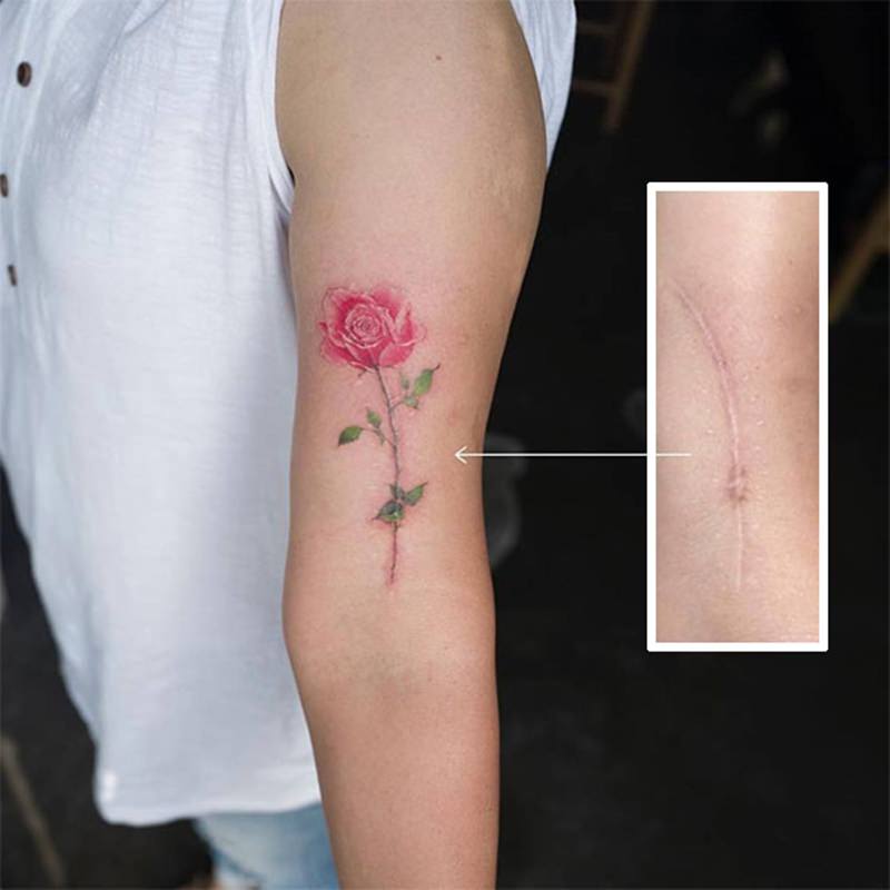 30 ideia criativas de tatuagem para embelezar qualquer cicatriz 36
